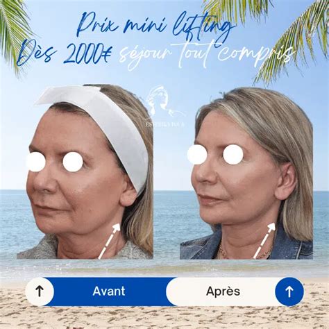 Visage Chirurgie Esthetique Prix And Interventions Devis Gratuit 2024