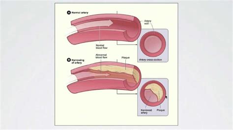 055 Regulating Peripheral Resistance - Part 1 | Interactive Biology ...