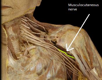 Brachialis Muscle | Definition, Function & Location | Study.com