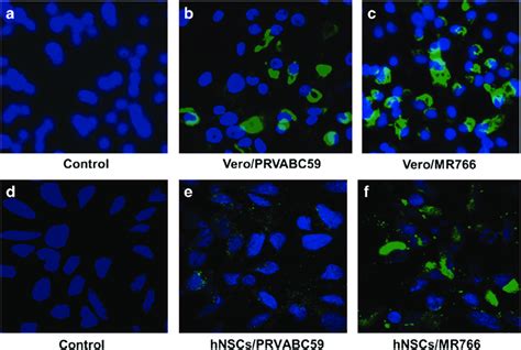 Subcellular Localization Of Zika Virus E Glycoprotein In Virus Infected