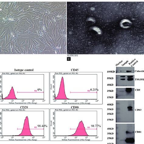 Characterization Of Exosomes Secreted By BM MSCs A The Morphology Of