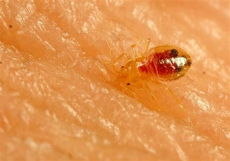 Bed Bug Rash Symptoms | BangDodo