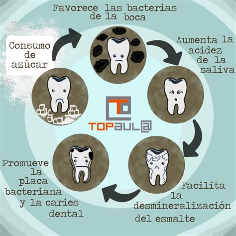 ¿cómo Afecta El Exceso De Azúcar A Tu Salud Dental Top Aul