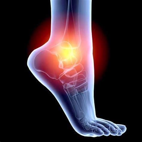 knee ankle foot  chris kostman md