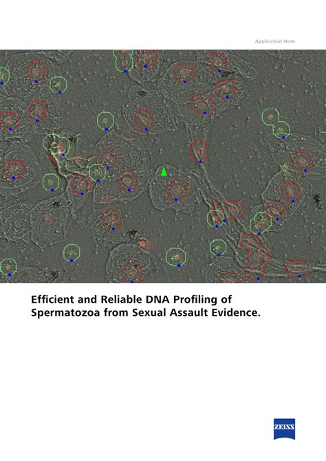 PDF Efficient And Reliable DNA Profiling Of Spermatozoa From Sexual