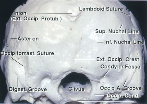 Suboccipital Craniotomy The Neurosurgical Atlas