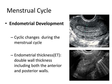 Basic gynae ultrasound