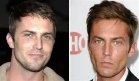 Desmond Harrington Doença - Desmond Harrington Clearly Shows Weight Loss - From His Face!
