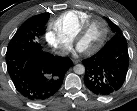 Multisystem Imaging Manifestations Of Covid Part Viral