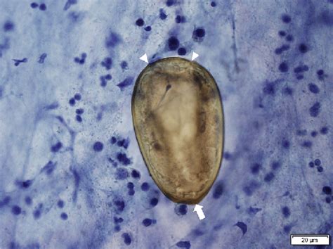 Photomicrograph Of An Egg Detected In A Papanicolaou Stained Sputum