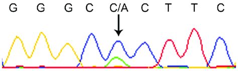 Chromatogram Showing The Nucleotide Sequence With The Novel Download Scientific Diagram