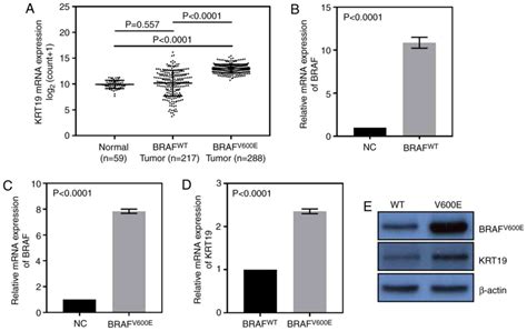 Brafv Einduced Krt Expression In Thyroid Cancer Promotes Lymph