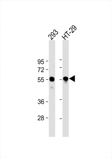 TP53 Antibody N Term Affinity Purified Rabbit Polyclonal Antibody