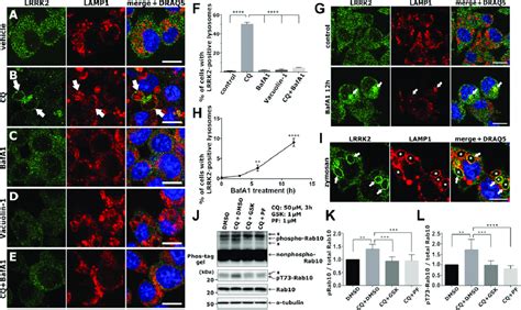 Lysosomal Overload Induces Translocation And Activation Of Lrrk A E