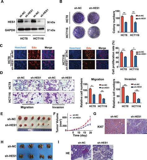 Knockdown Of Hes1 Inhibits The Malignant Behavior Of Crc Cells Invitro