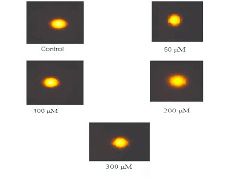 Single Cell Gel Electrophoresis Comet Assay Of Human Peripheral