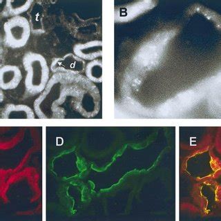 Indirect Immunofluorescence Micrographs Of Dmt Localization In Tal