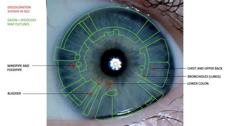 How To Read Iridology Eye Charts Ponasa