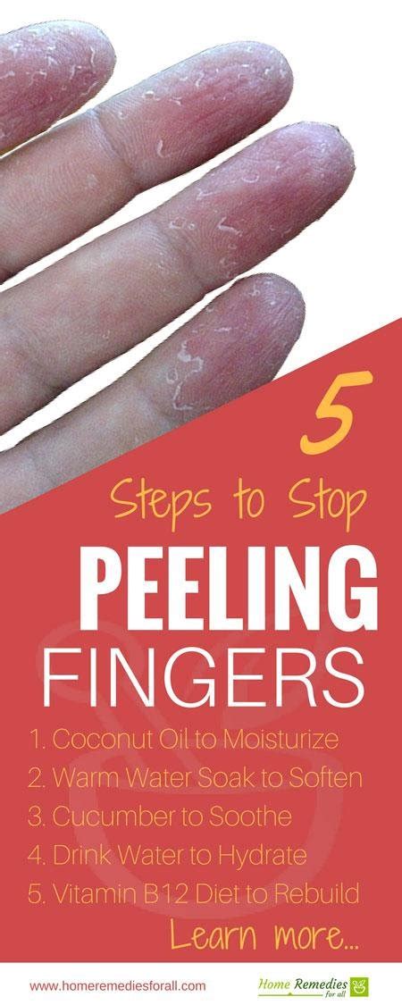 How To Stop Peeling Skin On Fingers Near Nails