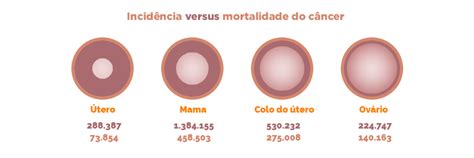 Câncer de Ovário Sintomas Diagnóstico e Como Detectar