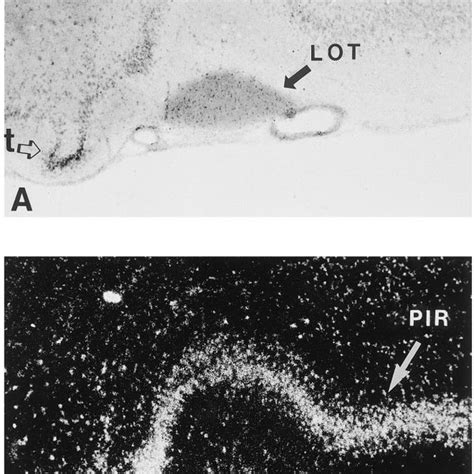 Piriform Cortex Photomicrographs Depicting Otr Mrna Labeling In The Download Scientific