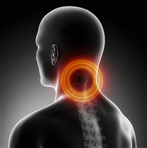 Cervical Laminectomy