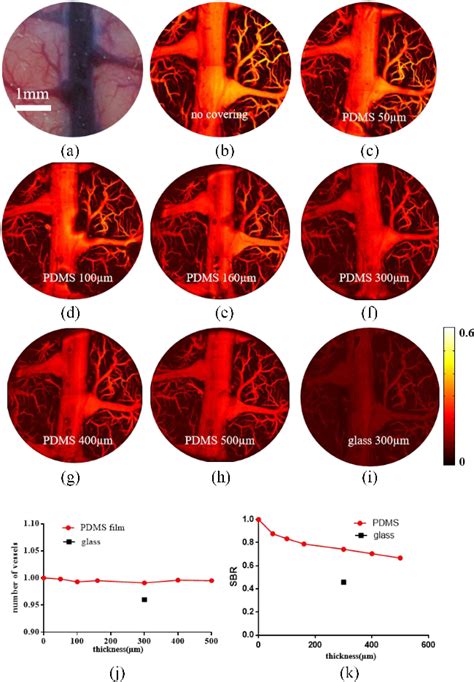 Figure 5 From A Long Term Cranial Window For High Resolution