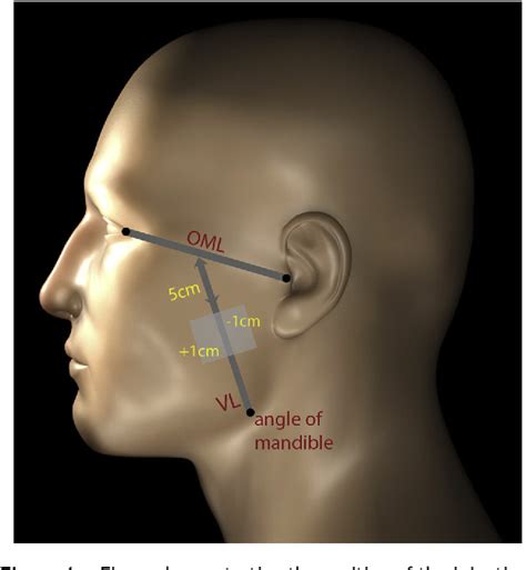 Structure Of Masseteric Nerve Semantic Scholar