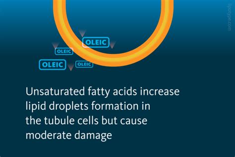 Lipids & kidney disease in diabetes - Lipotype GmbH