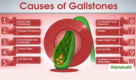 Gallstone: High Risk Groups, Diagnosis And Prevention Tips For ...