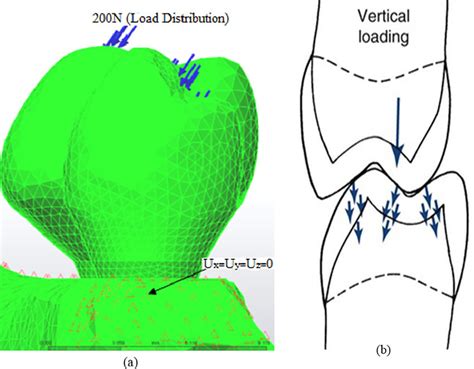 Three Dimensional Finite Element Model A And Schematic View Of Download Scientific Diagram