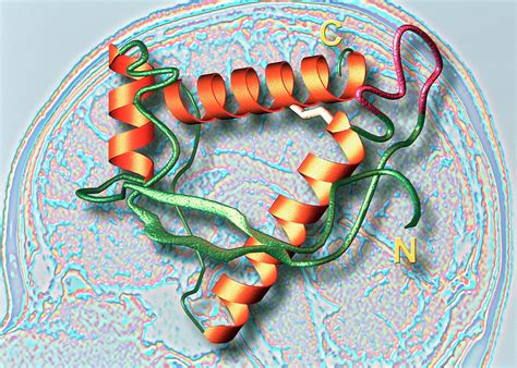 Prion Causing Cjd On Ct Scan Of Brain Photograph By Alfred Pasieka