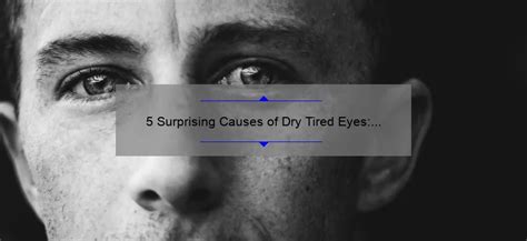 5 Surprising Causes of Dry Tired Eyes: How to Find Relief [Expert Tips ...