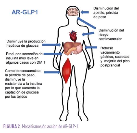 Diabetes tipo 1. ¿Podrían ser útiles los antidiabéticos no insulínicos ...