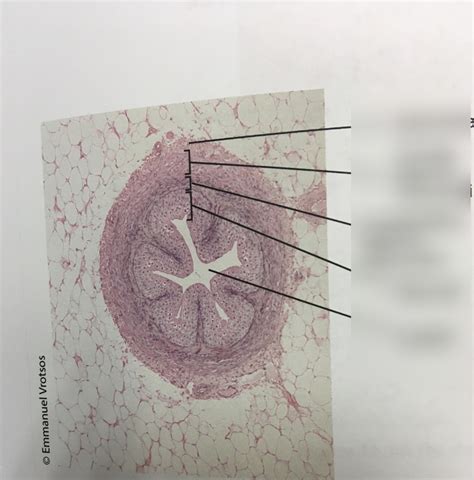 Urinary System Histology Ureter Diagram Quizlet