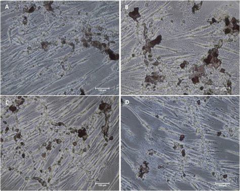 Alizarin Red S Staining Of Mscs Differentiated By Biomaterials At Day Download Scientific