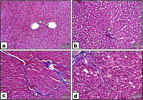 Photomicrographs Of Liver Sections Stained By Mt Stain In A Control And Download Scientific