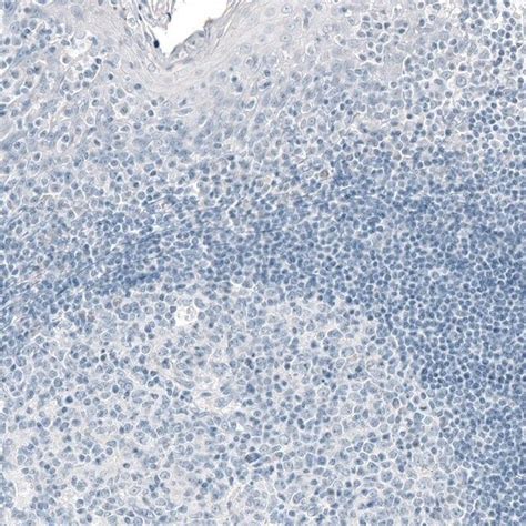 Monoclonal Anti Prl Antibody Produced In Mouse