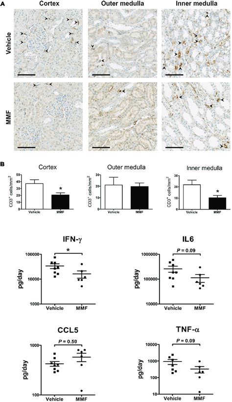 Immunohistochemistry Data And Urinary Chemokines Cytokine Excretion