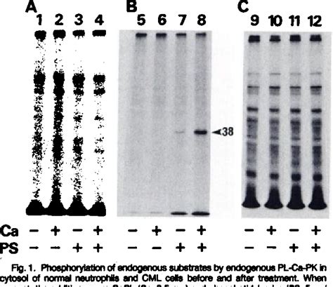 Figure From Translocation Of Phospholipid Sensitive Ca Dependent