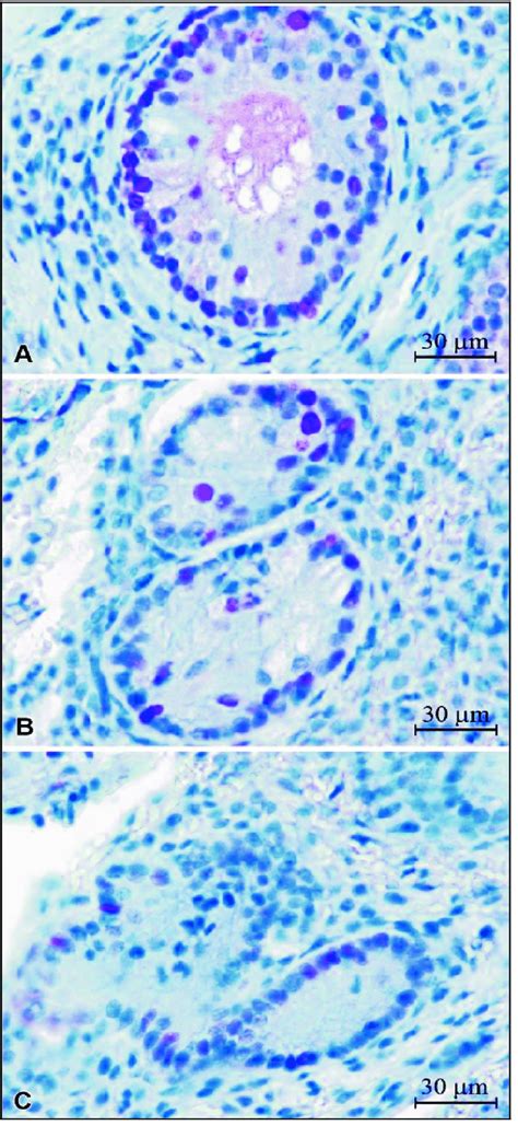 Positive Pcna Protein Staining A Group C Primary Follicle With Download Scientific Diagram