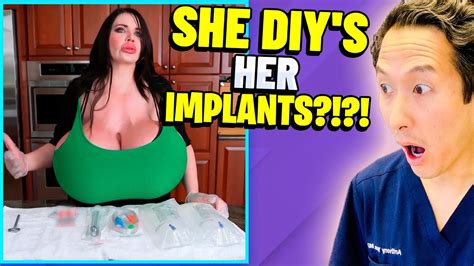 The Largest Implants In Us Extreme Bodies Explained Youtube