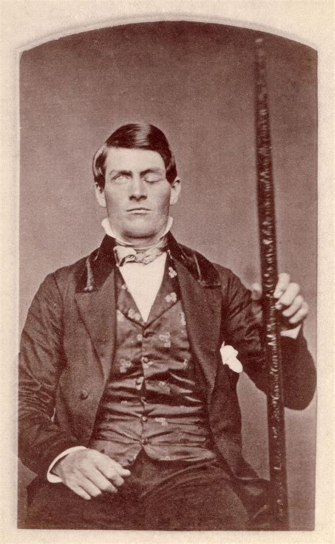 Phineas Gage Biography Injury And Facts Britannica