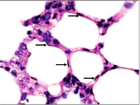 Alveoli Histology Labeled