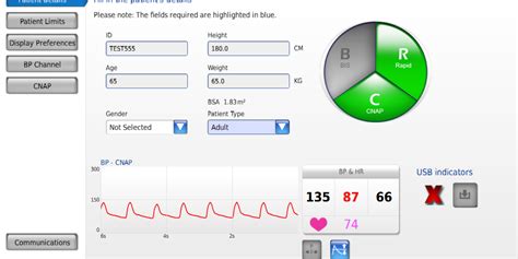 New Features LiDCO Hemodynamic Monitoring For The Entire Patient