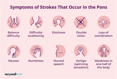 What Is A Pontine Stroke And How Does It Affect The Brain