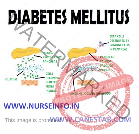 Diabetes Mellitus Nurse Info