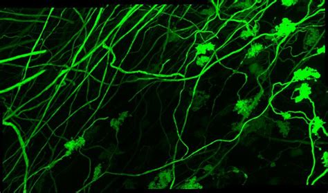 New Method Visualizes Groups Of Neurons As They Compute Healing Tao USA