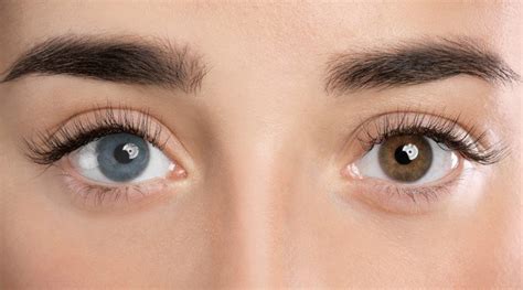 5 Natural Methods To Change Eye Color Permanently