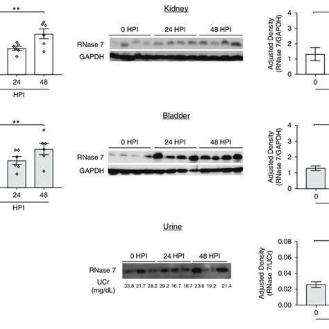 Rnase 7 Expression Is Induced In Vivo With Experimental Uti A And B Download Scientific